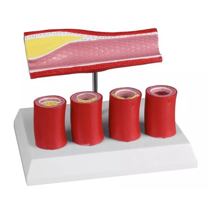 Artères avec 4 coupes d'artère - EZ Augmented Anatomy Artères avec 4 coupes d'artère - EZ Augmented Anatomy