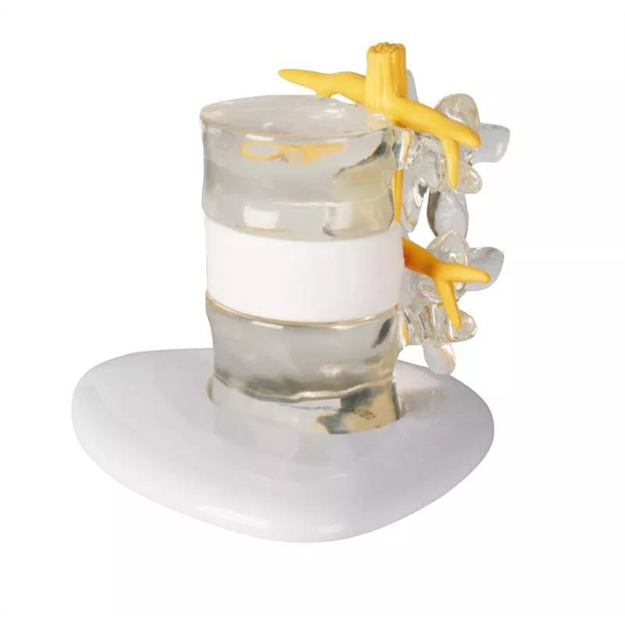 Herniated disc simulator Herniated disc simulator