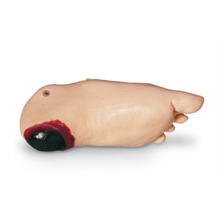 Pressure Ulcer Foot for GERI/KERI Pressure Ulcer Foot for GERI/KERI